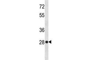 HMGB-1 antibody western blot analysis in HeLa lysate.