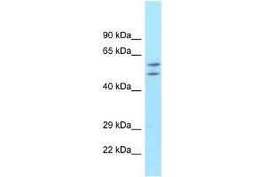 ATG16L1 antibody used at 1 ug/ml to detect target protein. (ATG16L1 anticorps)