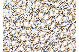 ABIN6261725 and ABIN6278861 at 1/100 staining Rat kidney tissue by IHC-P. (FGF21 anticorps  (C-Term))