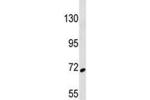 SYK antibody western blot analysis in 293 lysate