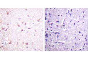 Peptide - + (DRP2 anticorps  (Thr514))