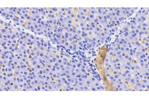Detection of HB in Human Liver Tissue using Polyclonal Antibody to Hemoglobin (HB) (Hemoglobin anticorps)