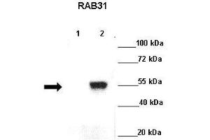 Lanes : Lane 1: GFP-Rab5 transfected cos cellsLane 2: GFP-Rab31 transfected cos cells  Primary Antibody Dilution :  1:500   Secondary Antibody : Goat anti rabbit-HRP  Secondary Antibody Dilution :  1:5000  Gene Name : RAB31  Submitted by : Ruth Herbst, Medical University Vienna (RAB31 anticorps  (C-Term))