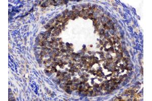 TCP1 epsilon was detected in paraffin-embedded sections of mouse ovary tissues using rabbit anti- TCP1 epsilon Antigen Affinity purified polyclonal antibody (Catalog # ) at 1 µg/mL.