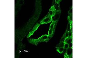 Immunohistochemistry analysis using Rabbit Anti-ENaC Polyclonal Antibody (ABIN863203).