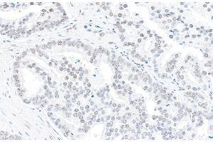 Immunohistochemistry (IHC) image for anti-ATP-Dependent RNA Helicase A (DHX9) (C-Term) antibody (ABIN7453848)