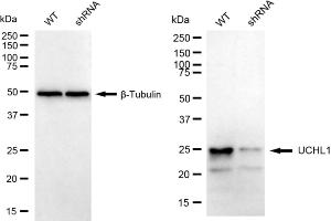 Western blotting analysis using UCHL1 antibody (ABIN7800707).