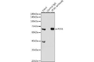 Immunoprecipitation analysis of 300 μg extracts of Mouse liver cells using 3 μg PCK1 antibody (ABIN3022753, ABIN3022754, ABIN3022755 and ABIN6219210).