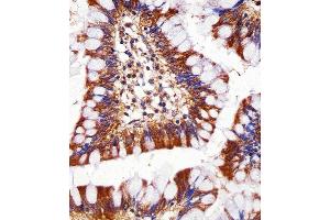 Immunohistochemical analysis of paraffin-embedded H. (PSMC1 anticorps  (C-Term))