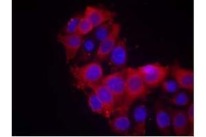 Image no. 2 for anti-VEGF Receptor 2 (VEGFR2) (AA 1212-1216) antibody (ABIN197238) (VEGFR2/CD309 anticorps  (AA 1212-1216))