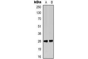 Western blot analysis of BCL2 (pT56) expression in Jurkat (A), rat muscle (B) whole cell lysates. (Bcl-2 anticorps  (pSer56))