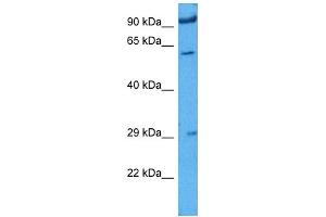 Host:  Rabbit  Target Name:  IGF2BP1  Sample Tissue:  Rat Skeletal Muscle  Antibody Dilution:  1ug/ml (IGF2BP1 anticorps  (N-Term))