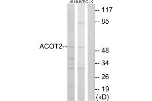 Western blot analysis of extracts from Jurkat cells and HuvEc cells, using ACOT2 antibody. (ACOT2 anticorps  (Internal Region))