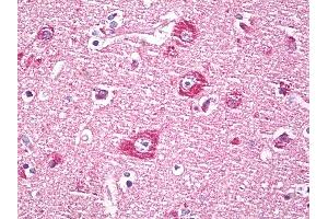 Anti-DACT1 / DAPPER antibody IHC of human brain, cortex neurons.