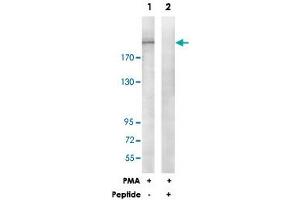 Western blot analysis of extracts from HepG2 cells, treated with PMA (125 ng/mL, 30 mins), using ITGB4 polyclonal antibody . (Integrin beta 4 anticorps)