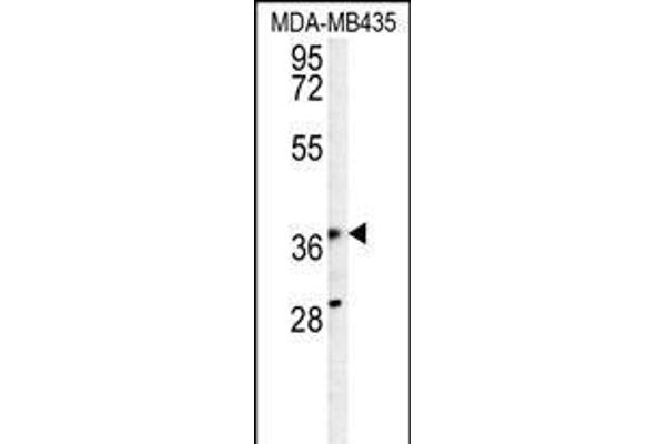 PRPSAP1 anticorps  (N-Term)