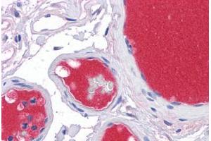 Human Vessels: Formalin-Fixed, Paraffin-Embedded (FFPE)