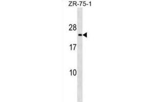 Western Blotting (WB) image for anti-Transmembrane Emp24 Protein Transport Domain Containing 3 (TMED3) antibody (ABIN2999507) (TMED3 anticorps)
