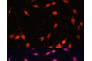 Immunofluorescence analysis of C6 cells using ZNF416 Polyclonal Antibody at dilution of 1:100. (ZNF416 anticorps)