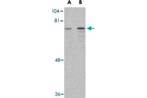 Western blot analysis of DDX3X in HepG2 cell lysate with DDX3X polyclonal antibody  at (A) 1 and (B) 2 ug/mL .