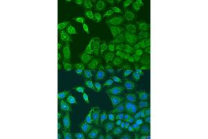 Immunofluorescence analysis of U2OS cells using AANAT antibody (ABIN6293599) at dilution of 1:100. (AANAT anticorps)