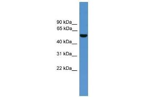ALDH9A1 antibody used at 0. (ALDH9A1 anticorps  (C-Term))