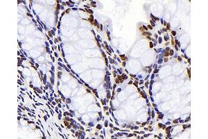 Immunohistochemistry analysis of paraffin-embedded mouse colon using S100A4 Monoclonal Antibody at dilution of 1:300. (s100a4 anticorps)