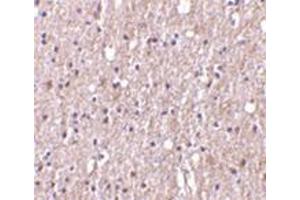 Immunohistochemistry of TWEAK in human brain tissue with this product at 10 μg/ml. (TWEAK anticorps)