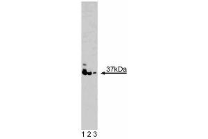 Western blot analysis of PINCH on K-562 lysate. (LIMS1 anticorps  (AA 120-220))