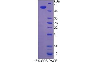 Image no. 1 for Transcription Termination Factor, RNA Polymerase I (TTF1) (AA 1-204) protein (His tag,GST tag) (ABIN6237181)