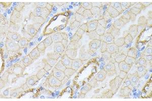 Immunohistochemistry of paraffin-embedded Mouse kidney using SPTAN1 Polyclonal Antibody at dilution of 1:100 (40x lens).