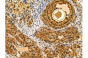ABIN6262320 and ABIN6268811 at 1/100 staining Rat ovarian tissue by IHC-P. (RBMX anticorps  (N-Term))