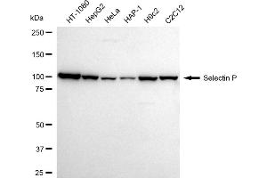 Western blotting analysis using Selectin P antibody (ABIN7800291).