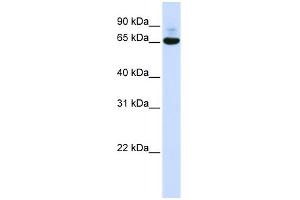 WB Suggested Anti-CNOT4 Antibody Titration:  0. (CNOT4 anticorps  (N-Term))
