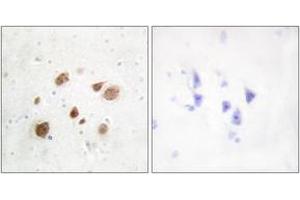 Immunohistochemistry (IHC) image for anti-Pregnancy Up-Regulated Non-Ubiquitously Expressed CaM Kinase (PNCK) (AA 161-210) antibody (ABIN2889644) (PNCK anticorps  (AA 161-210))