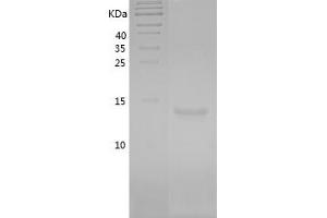 Western Blotting (WB) image for Leptin (LEP) (AA 22-167) protein (His tag) (ABIN7123746)
