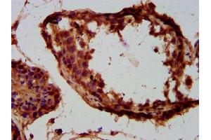 anti-Tumor Suppressor Candidate 3 (TUSC3) (AA 42-196) antibody