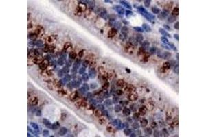 Immunohistochemical staining of TRPA1 on mouse intestine with TRPA1 polyclonal antibody . (TRPA1 anticorps  (AA 1-100))