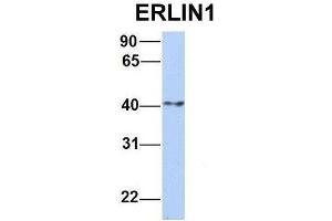 Host:  Rabbit  Target Name:  ERLIN1  Sample Type:  Human MCF7  Antibody Dilution:  1. (ERLIN1 anticorps  (N-Term))