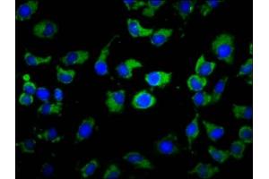 Immunofluorescence staining of A549 cells with ABIN7155184 at 1:133, counter-stained with DAPI.