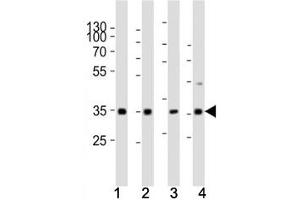 Western blot analysis of lysate from (1) human HeLa cell line, (2) mouse spleen, (3) rat lung, (4) rat stomach tissue using Cyclin D3 antibody at 1:1000.