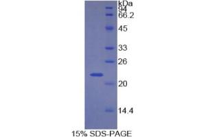 SDS-PAGE analysis of Human CDKN1A Protein. (p21 Protéine)
