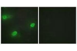 Immunofluorescence analysis of HeLa cells, using CSTF2 antibody.