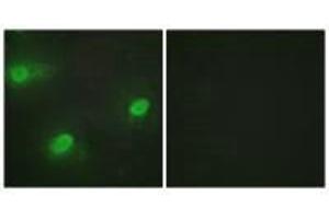 Immunofluorescence analysis of HeLa cells, using CSTF2 antibody. (CSTF2 anticorps  (N-Term))