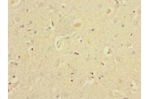 Immunohistochemistry of paraffin-embedded human brain tissue using ABIN7151514 at dilution of 1:100 (EAF2 anticorps  (AA 1-170))