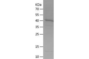 Western Blotting (WB) image for CD86 (CD86) (AA 48-244) protein (His-IF2DI Tag) (ABIN7122216)