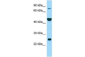 Western Blotting (WB) image for anti-Peptidyl Arginine Deiminase, Type VI (PADI6) (N-Term) antibody (ABIN2790272) (PADI6 anticorps  (N-Term))