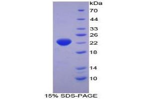 SDS-PAGE analysis of Human HSPb2 Protein. (HSPB2 Protéine)
