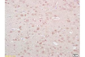 Formalin-fixed and paraffin embedded rat brain labeled with Anti-NKA/Neurokinin A Polyclonal Antibody, Unconjugated (ABIN724445) at 1:200 followed by conjugation to the secondary antibody and DAB staining