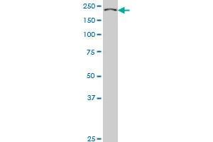KNTC1 monoclonal antibody (M01), clone 10H4 Western Blot analysis of KNTC1 expression in Hela S3 NE .